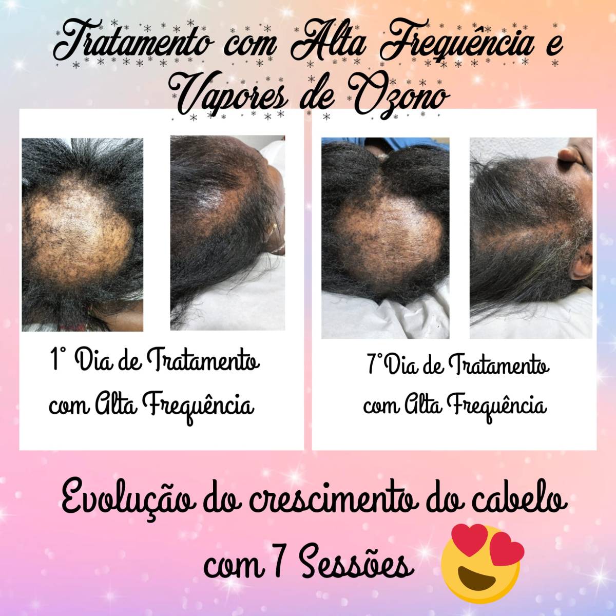 Clínica Lotus- Dra. Ágata Vieira - Setúbal - Tratamiento facial