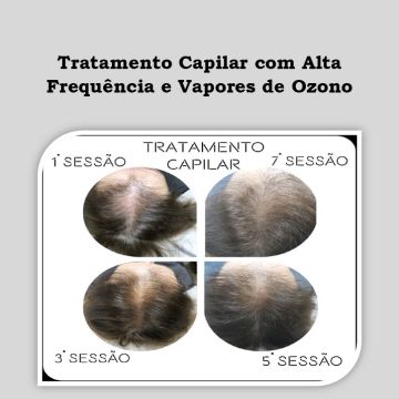 Clínica Lotus- Dra. Ágata Vieira - Setúbal - Terapias de masajes