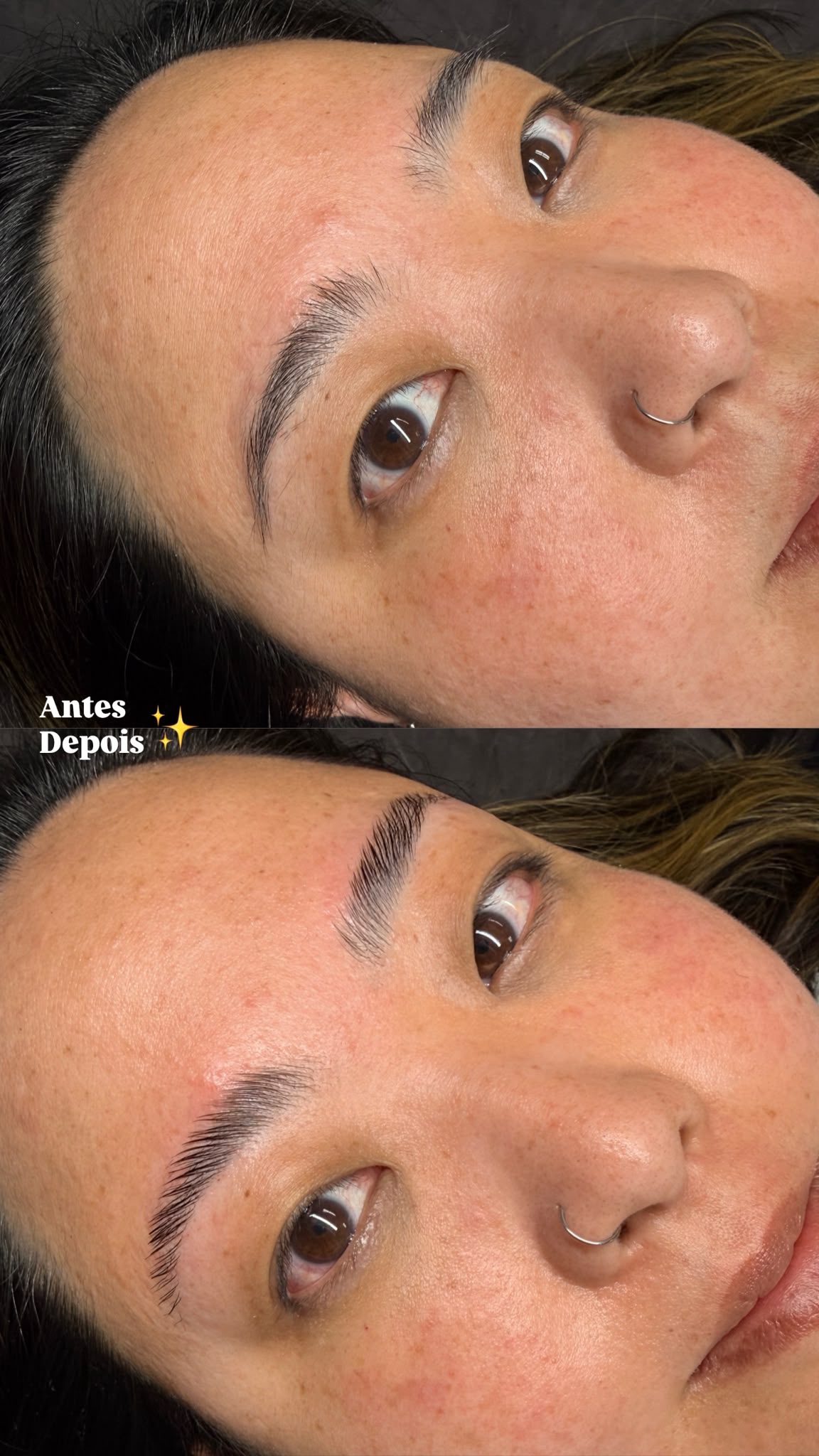 Camila Lopes - Braga - Skin Cleansing