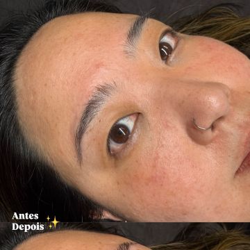 Camila Lopes - Braga - Skin Cleansing