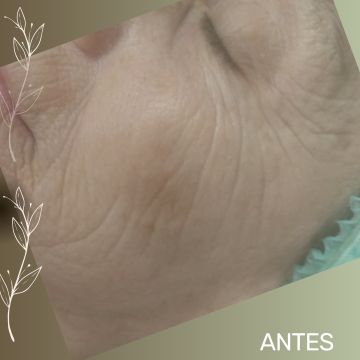 Aromatik Beauty Spa Massage - Lisboa - Psicoterapia