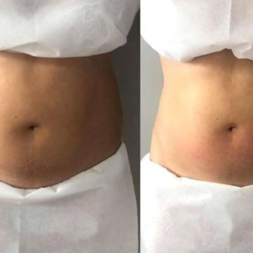 Olinda  Massoterapeuta - Vale de Cambra - Pregnancy Massage