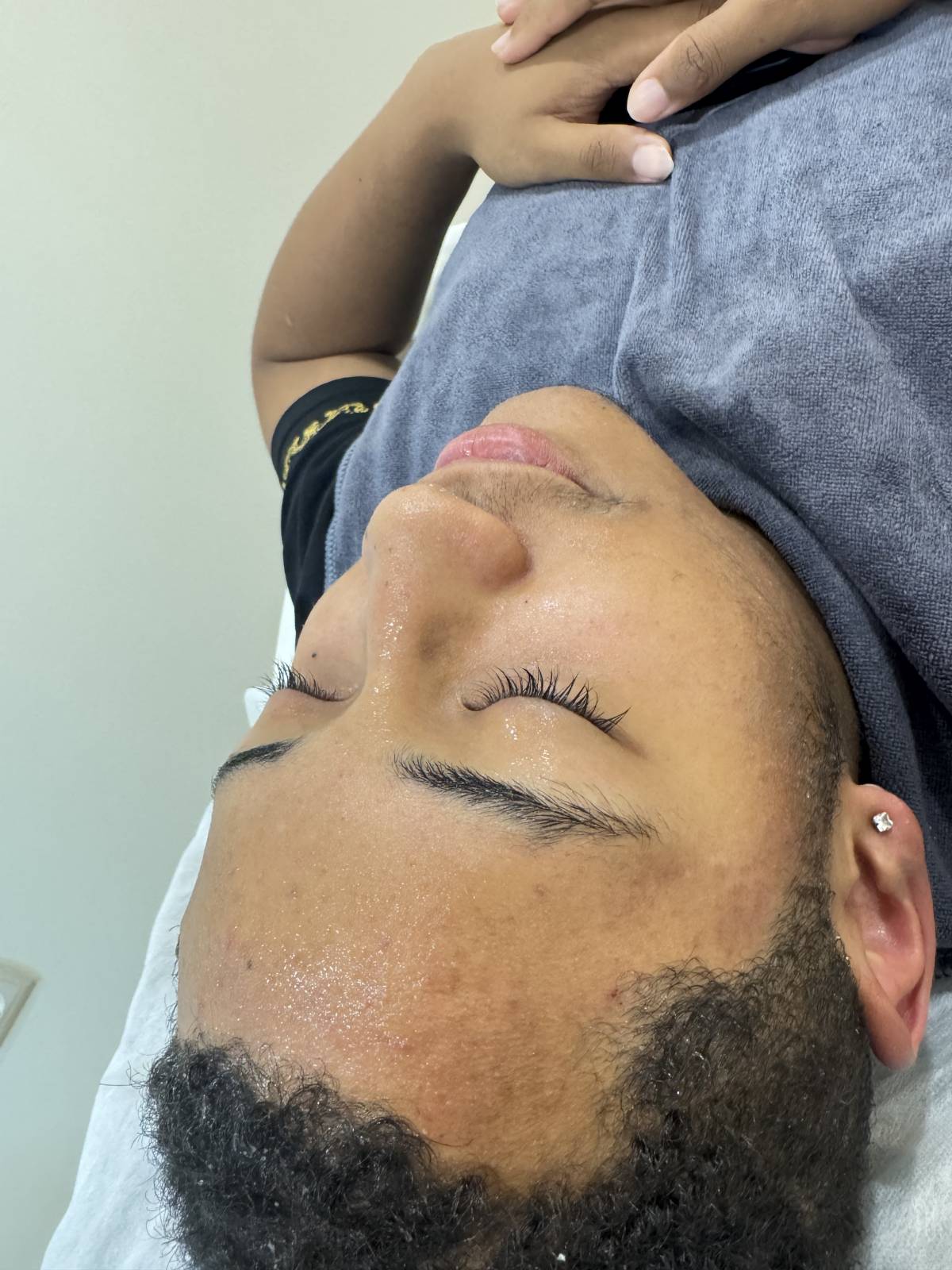 Ts estética personalizada - Sesimbra - Laser-Enthaarung