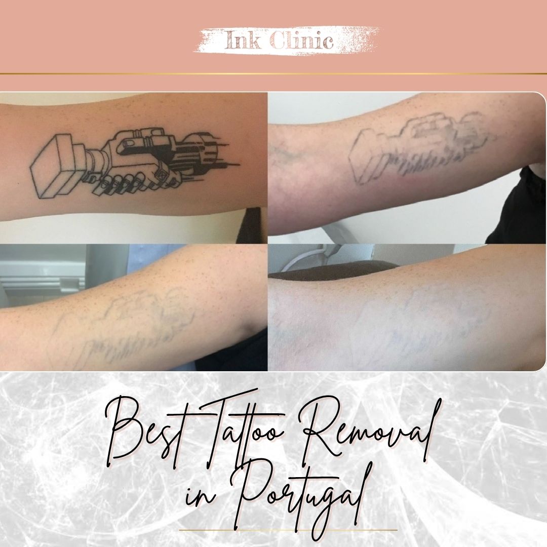 Ink Clinic Ericeira - Mafra - Tatuadores