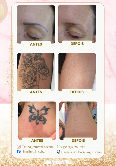 Ink Clinic Ericeira - Mafra - Beleza