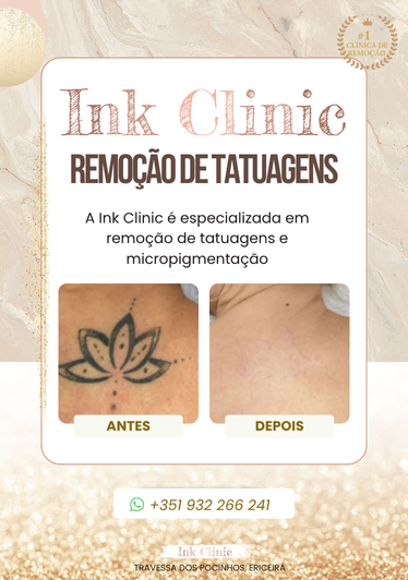 Ink Clinic Ericeira - Mafra - Limpeza de Pele