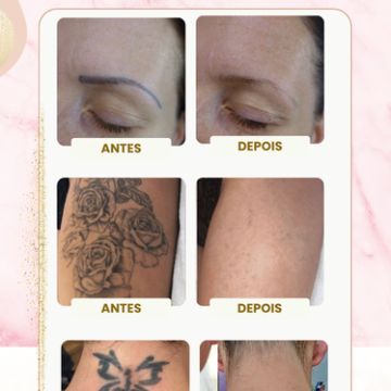 Ink Clinic Ericeira - Mafra - Beleza