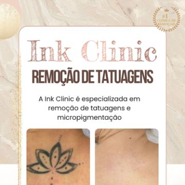 Ink Clinic Ericeira - Mafra - Limpeza de Pele
