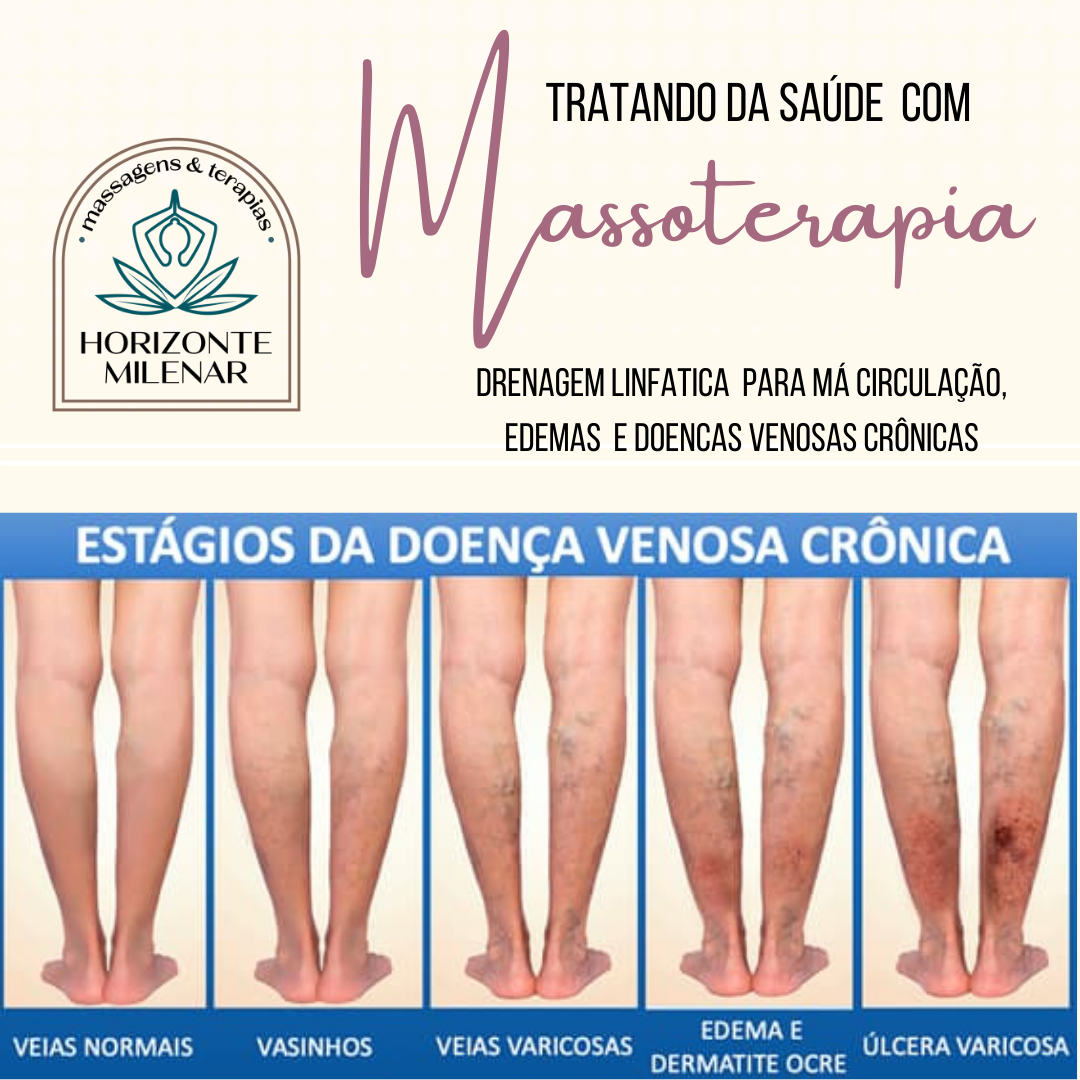 Horizonte Milenar Massagens e Terapias - Lisboa - Sports Massage