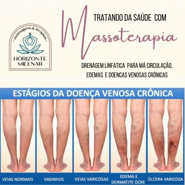 Horizonte Milenar Massagens e Terapias - Lisboa - Massagem Desportiva