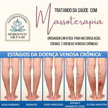 Horizonte Milenar Massagens e Terapias - Lisboa - Sports Massage