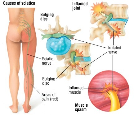 Virgilio - Benavente - Osteopathy