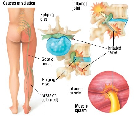 Virgilio - Benavente - Osteopatia