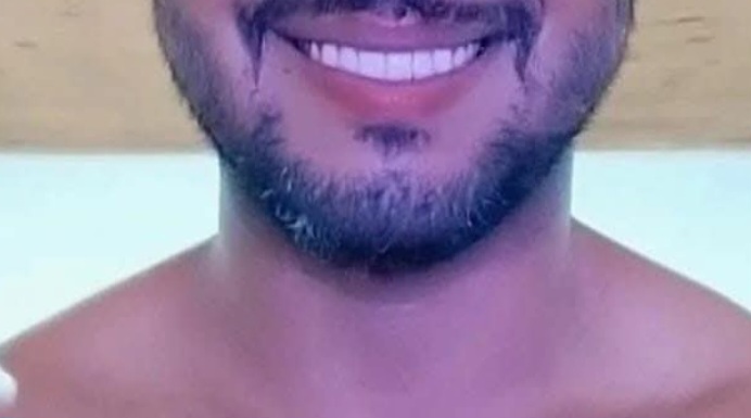 Lucas massoterapeuta particular - Amadora - Massagem com Pedras Quentes
