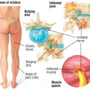 Virgilio - Benavente - Osteopathy