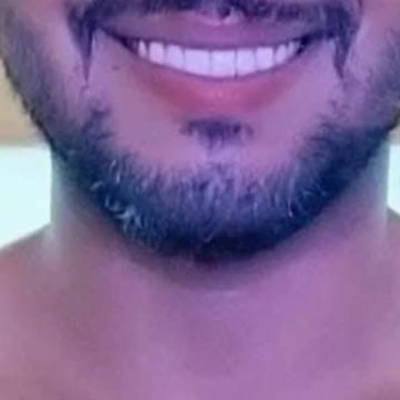 Lucas massoterapeuta particular - Amadora - Massagem com Pedras Quentes