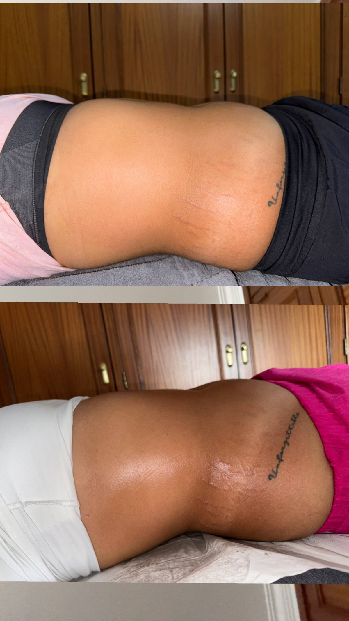 Lara Alfaiate - Alcanena - Sportmassage