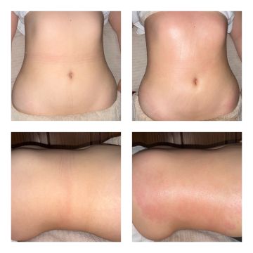 Lara Alfaiate - Alcanena - Hypnosetherapie