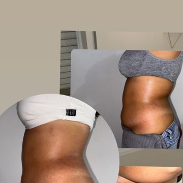 Lara Alfaiate - Alcanena - Schwangerschaftsmassage