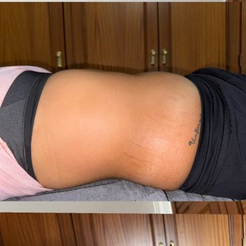 Lara Alfaiate - Alcanena - Sportmassage