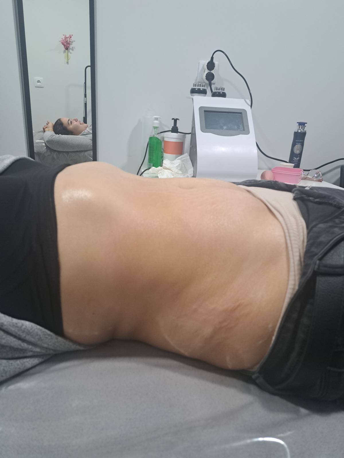 Aloma Fisioterapia - Seixal - Limpeza de Pele