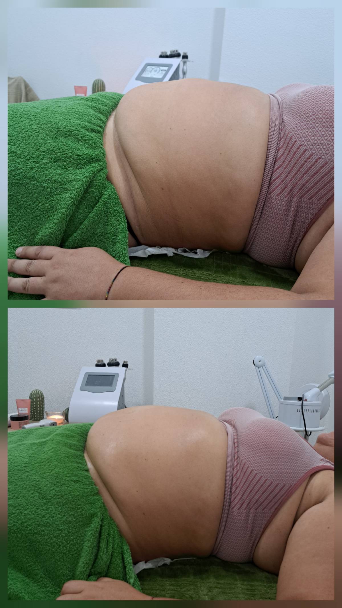 Aloma Fisioterapia - Seixal - Massagem para Grávidas