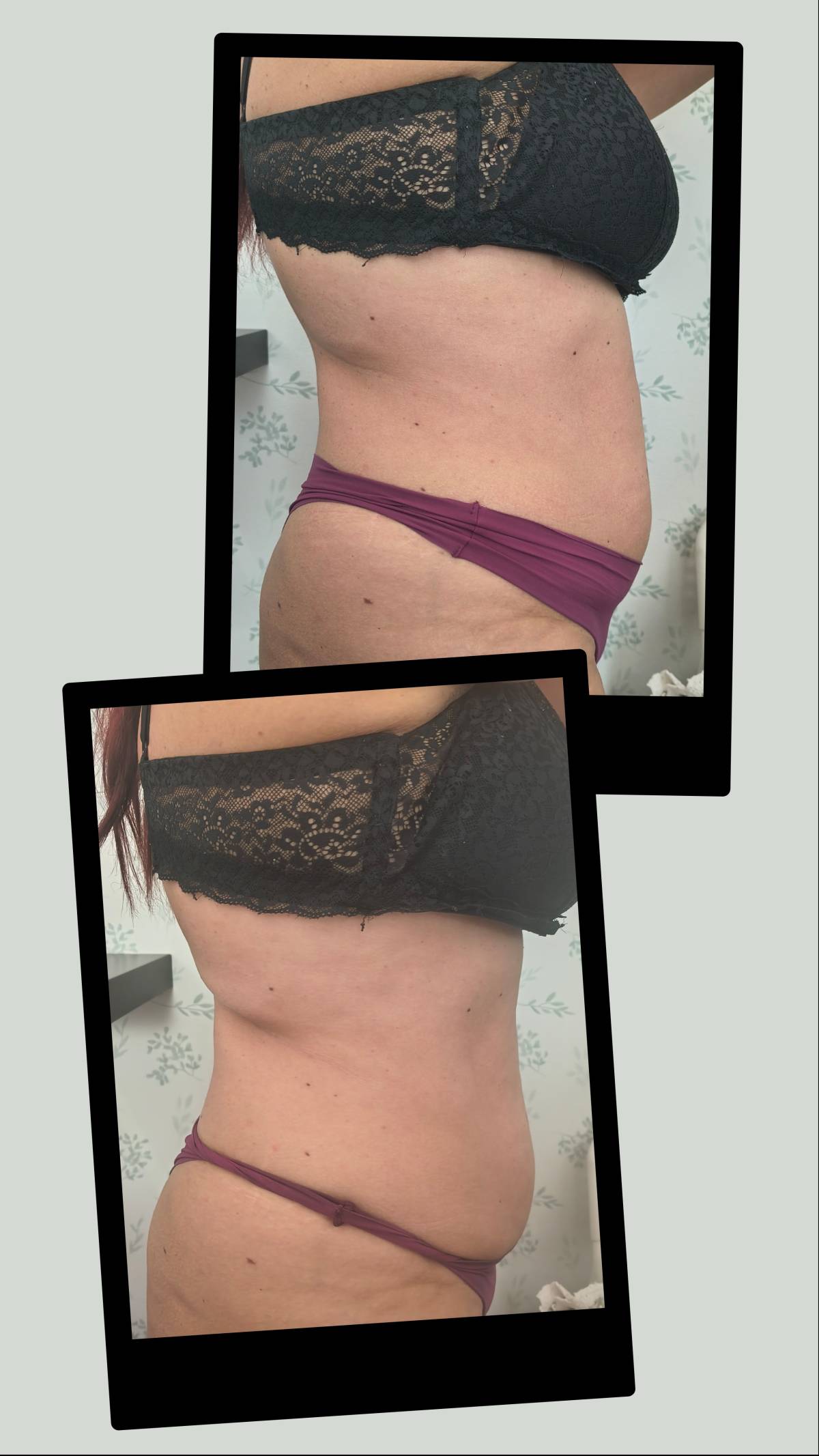 Aloma Fisioterapia - Seixal - Massagem Desportiva