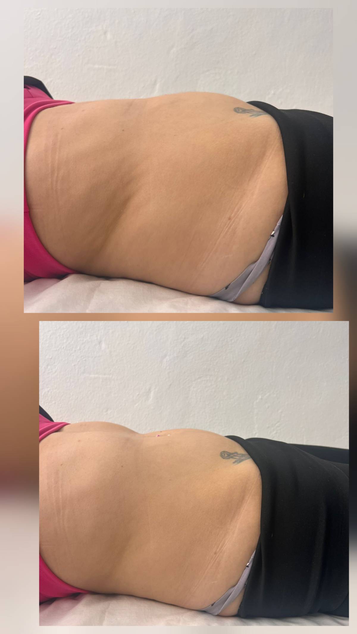 Aloma Fisioterapia - Seixal - Massagem Desportiva