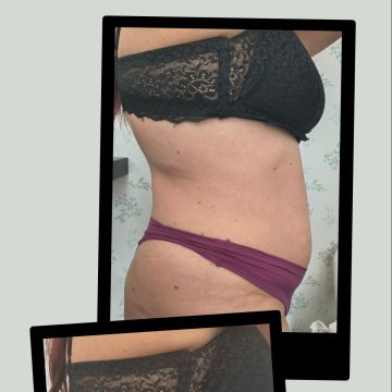 Aloma Fisioterapia - Seixal - Massagem Desportiva