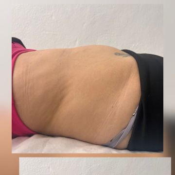Aloma Fisioterapia - Seixal - Massagem Desportiva