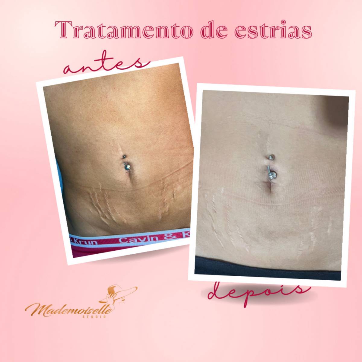 MademoiselleStudio - Santa Maria da Feira - Massagem para Grávidas