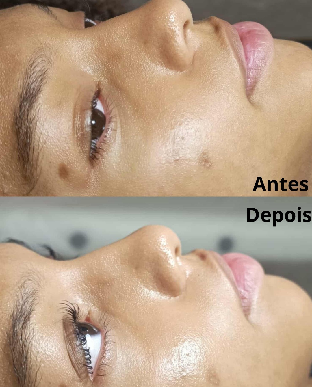 laserlashes_by_telma - Seixal - Beleza