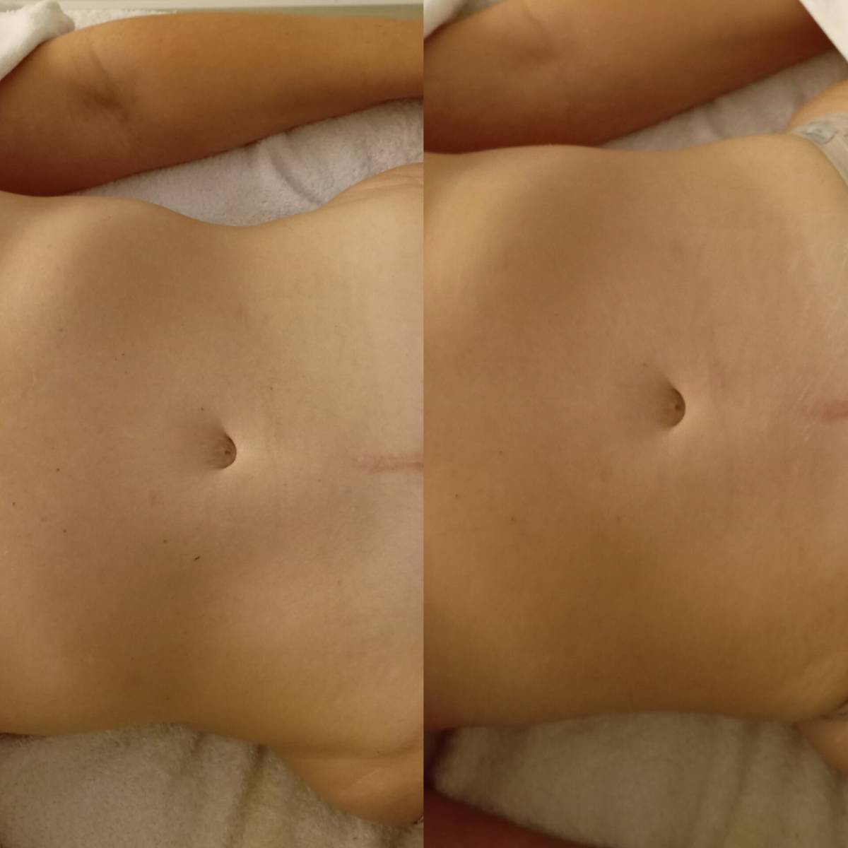 CARLA CORDHOLINO - Viana do Castelo - Massagem para Grávidas