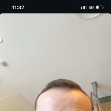 Aj - Aveiro - Nettoyage en profondeur