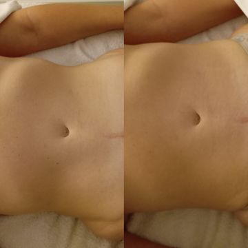 CARLA CORDHOLINO - Viana do Castelo - Massagem para Grávidas