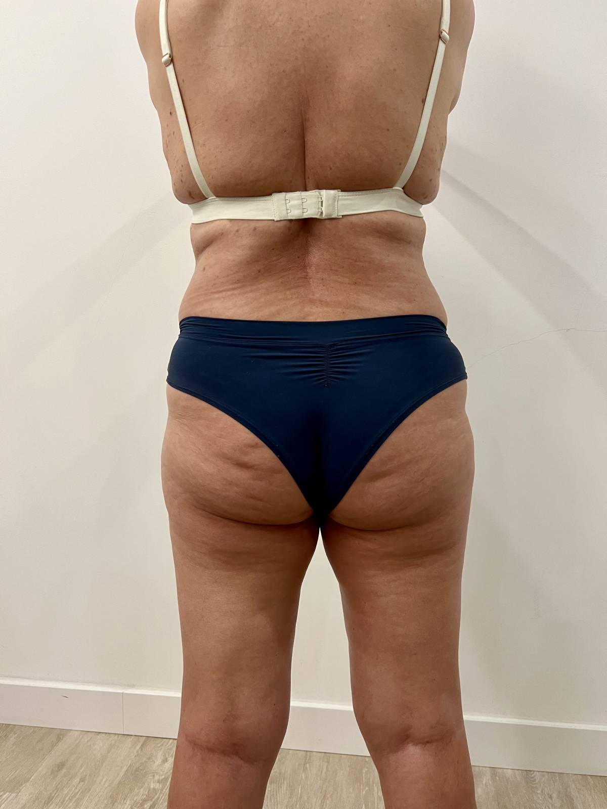 Julieth - Sesimbra - Massagem Desportiva