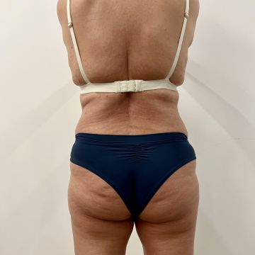 Julieth - Sesimbra - Massagem Desportiva