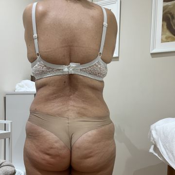 Julieth - Sesimbra - Massagem para Grávidas