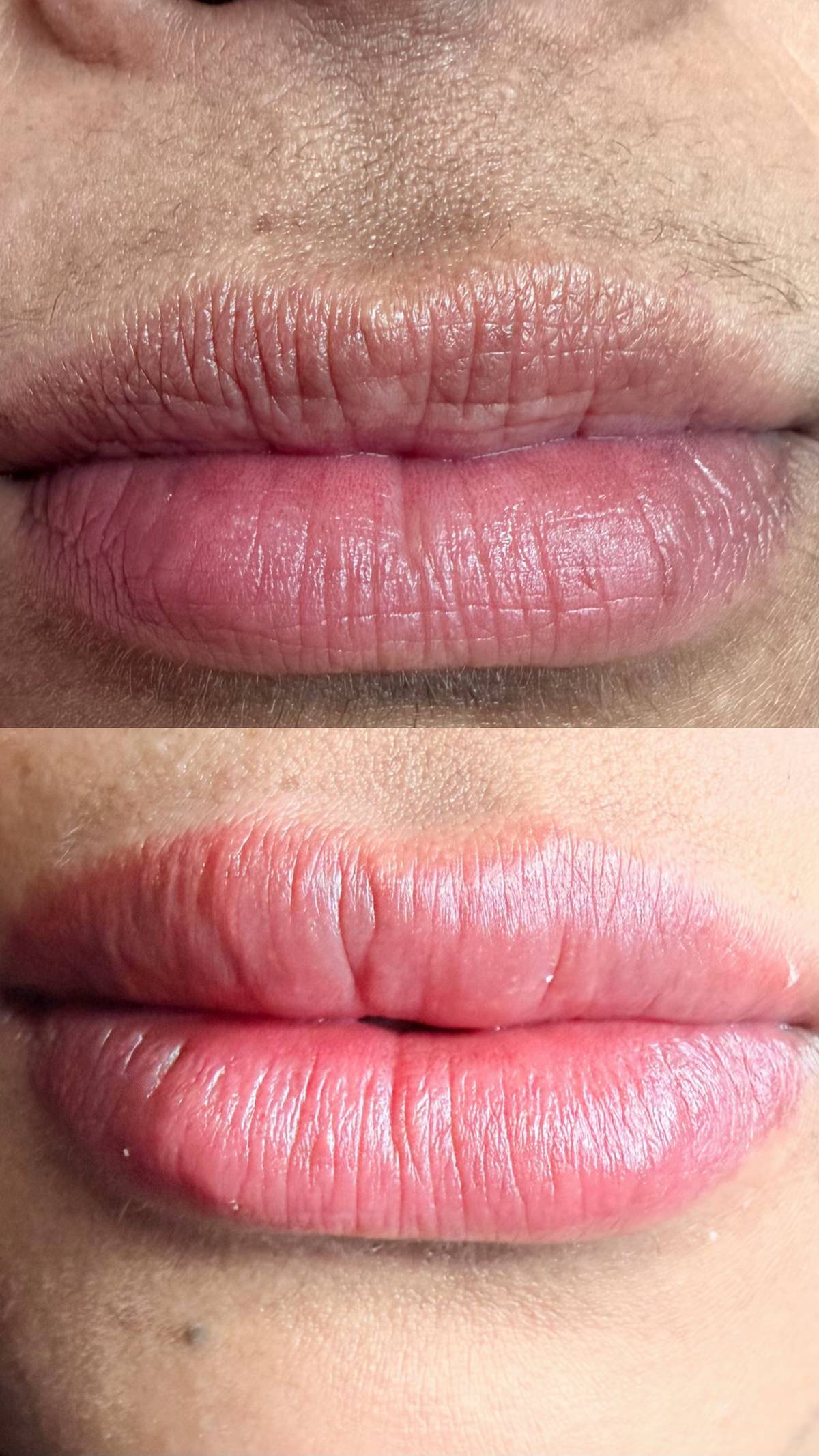 Eva Derm | Micropigmentação Labial & Laser - Figueira da Foz - Mikropigmentierung
