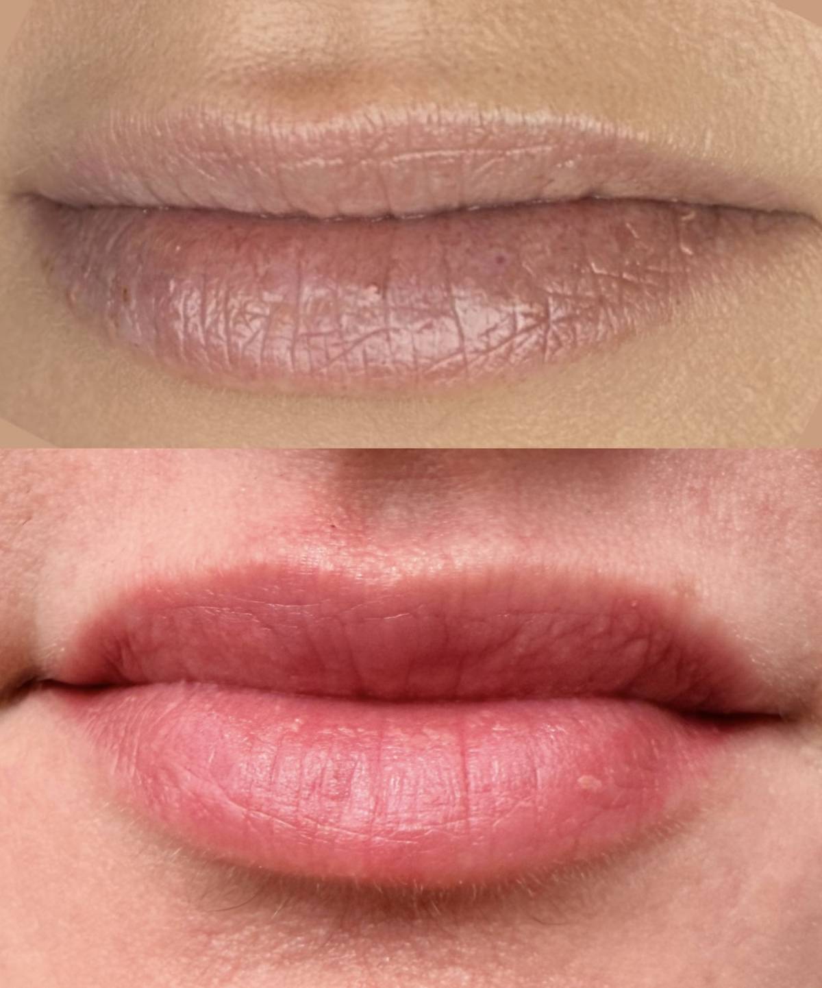 Eva Derm | Micropigmentação Labial & Laser - Figueira da Foz - Schönheitssalon