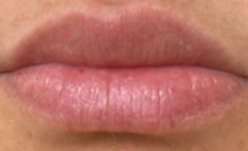 Eva Derm | Micropigmentação Labial & Laser - Figueira da Foz - Schönheitssalon