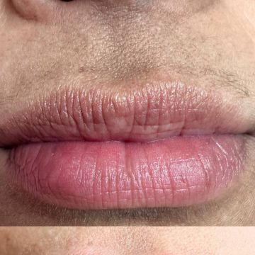 Eva Derm | Micropigmentação Labial & Laser - Figueira da Foz - Mikropigmentierung