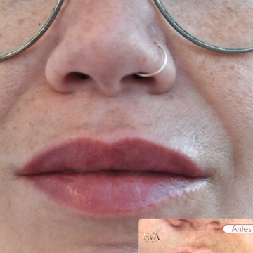 Eva Derm | Micropigmentação Labial & Laser - Figueira da Foz - Mikropigmentierung