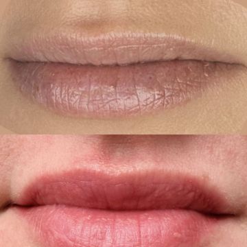 Eva Derm | Micropigmentação Labial & Laser - Figueira da Foz - Schönheitssalon