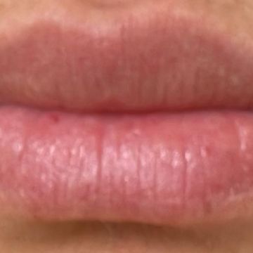 Eva Derm | Micropigmentação Labial & Laser - Figueira da Foz - Schönheitssalon
