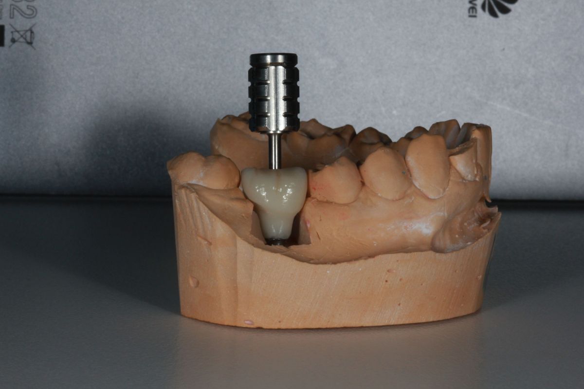 Clínica Dentarmed - Medicina Dentária - Almada - Cuidados Dentários