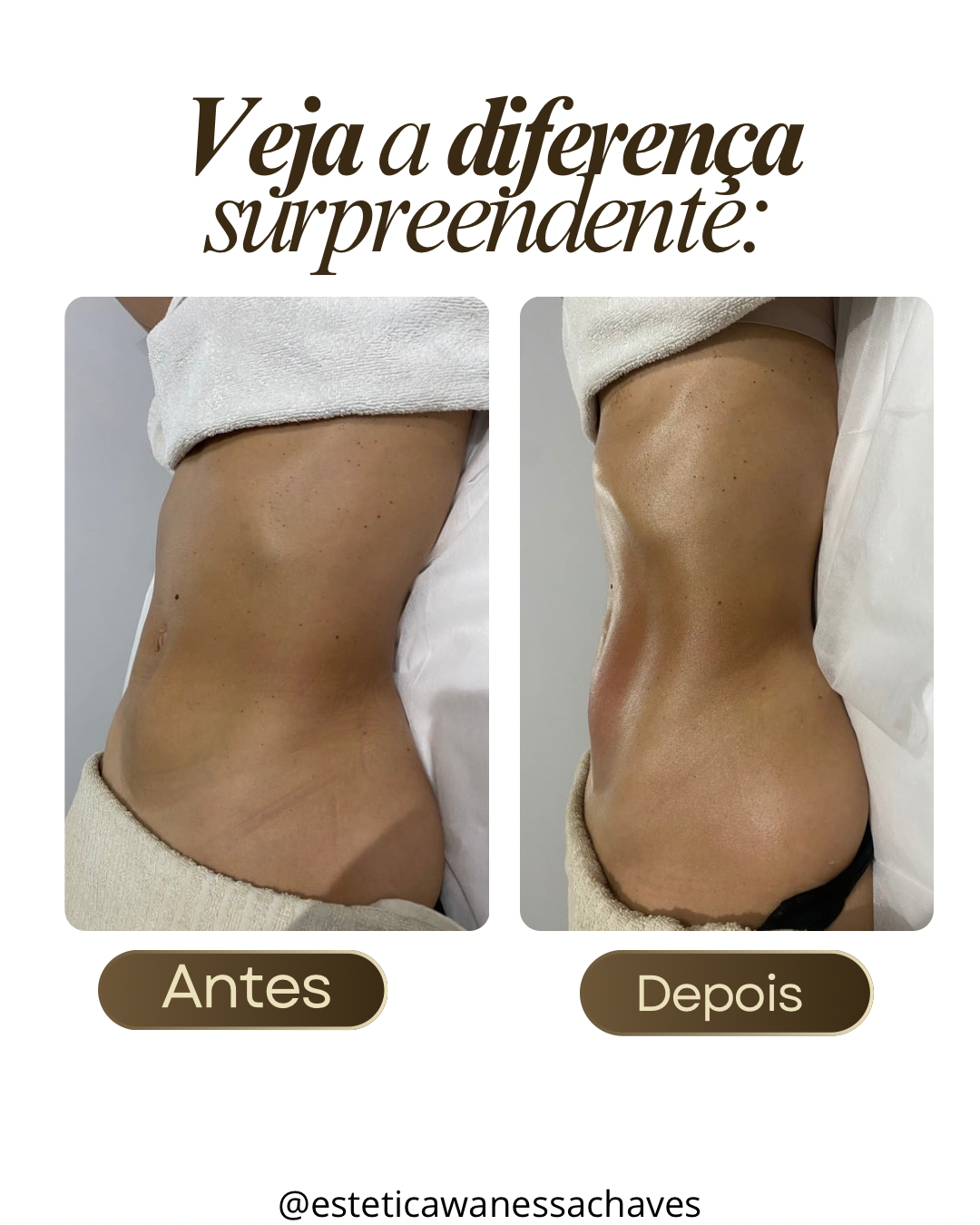 Estética Wanessa Chaves - Loures - Deep Tissue Massage