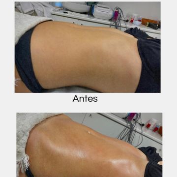 Estética Wanessa Chaves - Loures - Beauty services