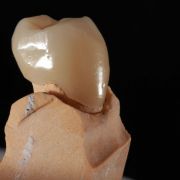 Clínica Dentarmed - Medicina Dentária - Almada - Dentistas