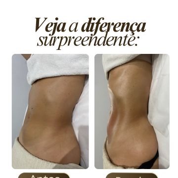 Estética Wanessa Chaves - Loures - Deep Tissue Massage